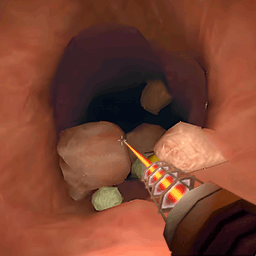 肠道清理专家游戏