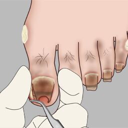 修脚大师模拟器游戏